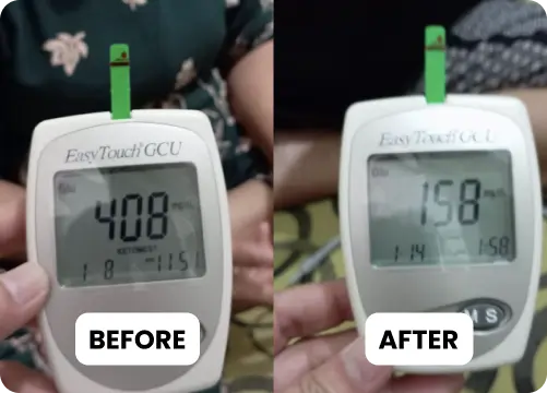 before after Rosmiati